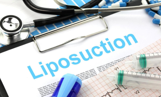 Who Is A Good Candidate For Liposuction in Turkey?